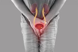 ಮೂತ್ರನಾಳದ ಸೋಂಕು: