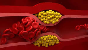 ಕೊಲೆಸ್ಟ್ರಾಲ್ ಬೆ