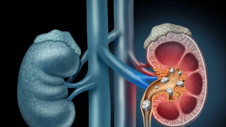 n68018435817573845020825c9d30cf905a31231e71fc336fa60c41a7f0804a7d873e739b8c1b8890689f6d