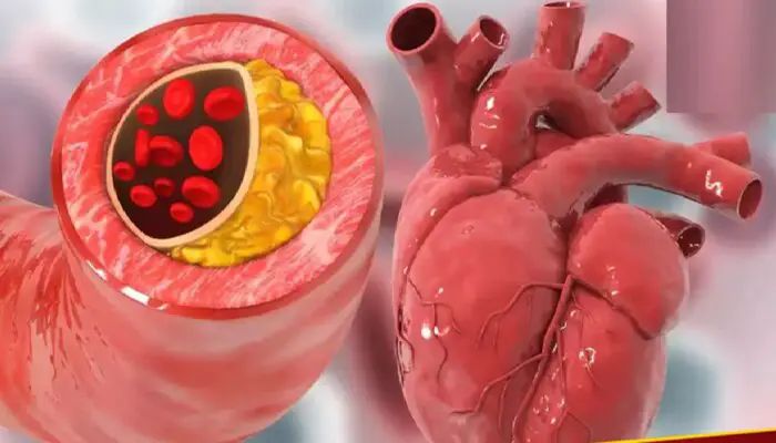 n68126992117585882047022f033c26c81cdde1597d5530c388de9d25e5babb3f9b081b5b435be55b21114d